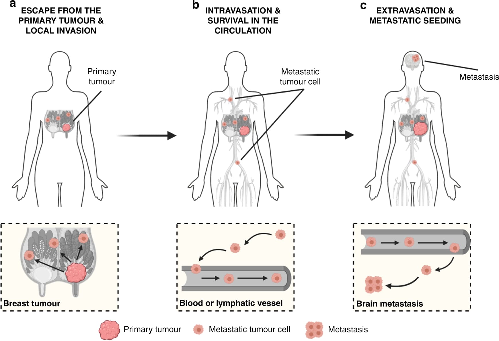 Arimidex is a crucial medication for postmenopausal women with hormone receptor-positive cancer