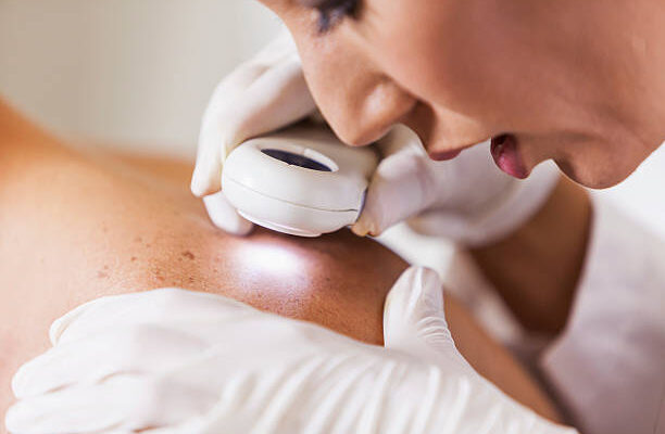 Skin Diseases Treatment in Abu Dhabi