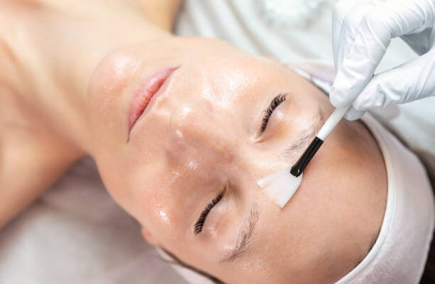 chemical peels in Abu Dhabi