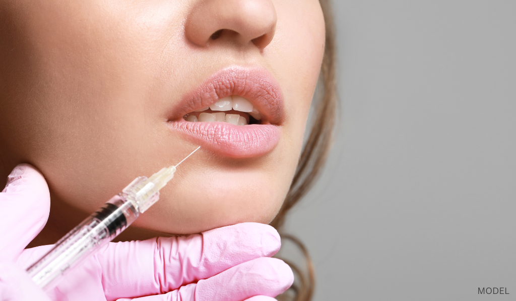 Lip Fillers in Dubai: What to Expect from Your Appointment