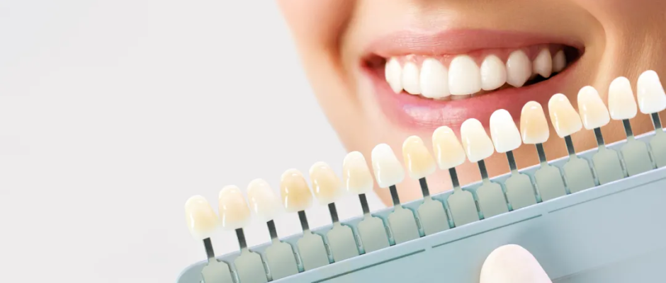 Dental Veneers Cost Dubai