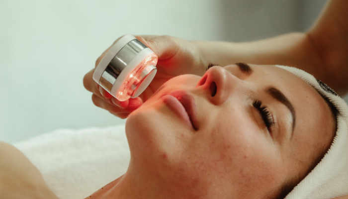 Acne Treatment in Dubai