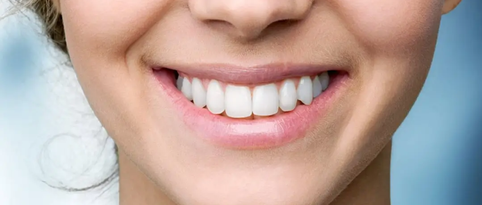 Is Teeth Whitening Safe Expert Insights