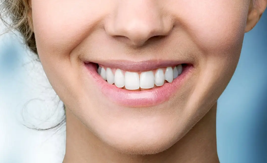 How to Choose the Best Time for Teeth Whitening?