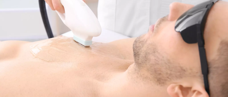 Male Laser Hair Removal