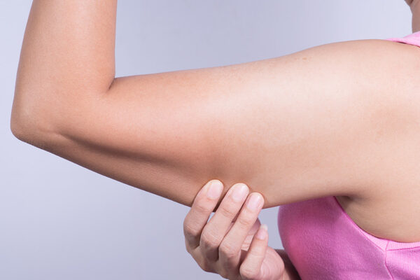 Arm Lift: The Best Solution for Loose Arm Skin