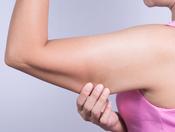 Arm Lift: The Best Solution for Loose Arm Skin