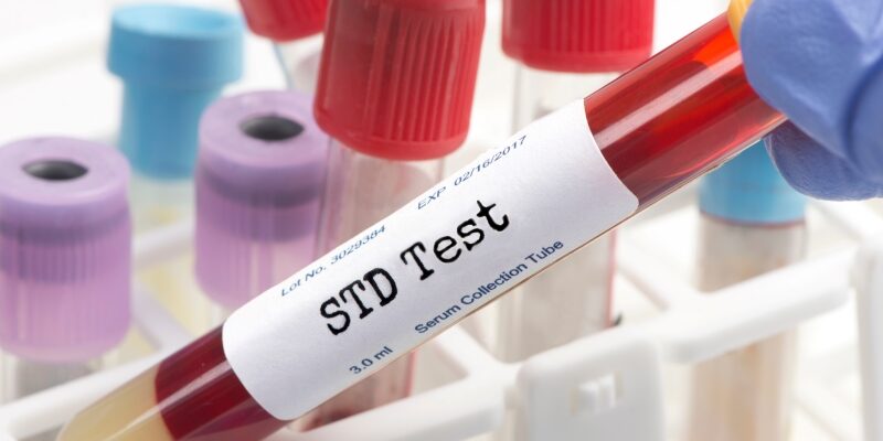 Can STD Treatment Help with Recurrent Infections