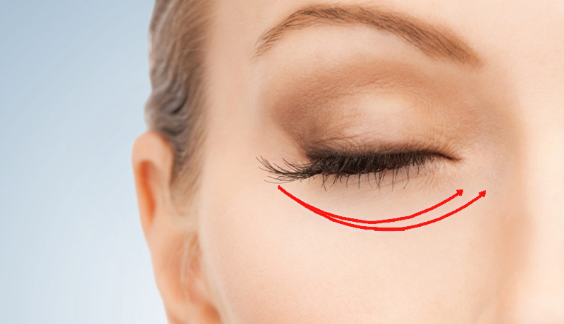 Eyelid Surgery: Restore Youthful Eyes with Minimal Recovery