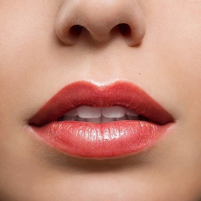 Lip augmentation in Islamabad