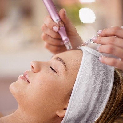 Micro needling treatment in Islamabad