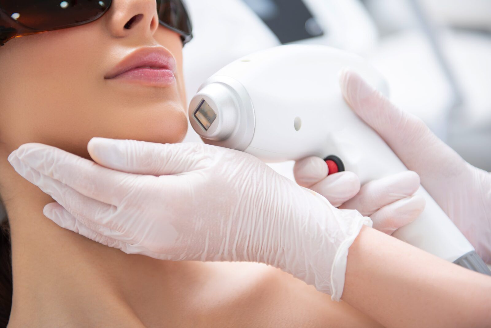 Transform Your Complexion with Advanced Laser Therapies